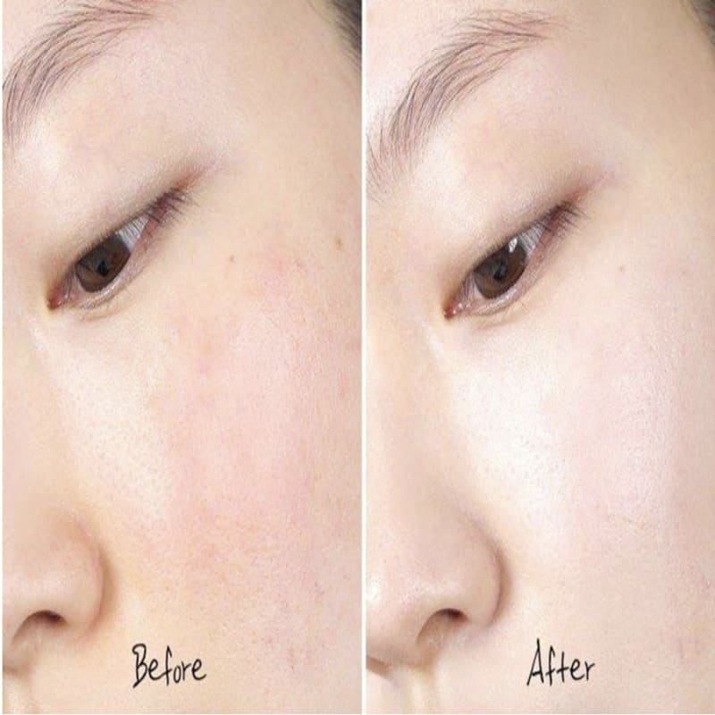 cushion cho da dau hieu ung thuc te tren lan da